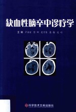 缺血性脑卒中诊疗学 封面