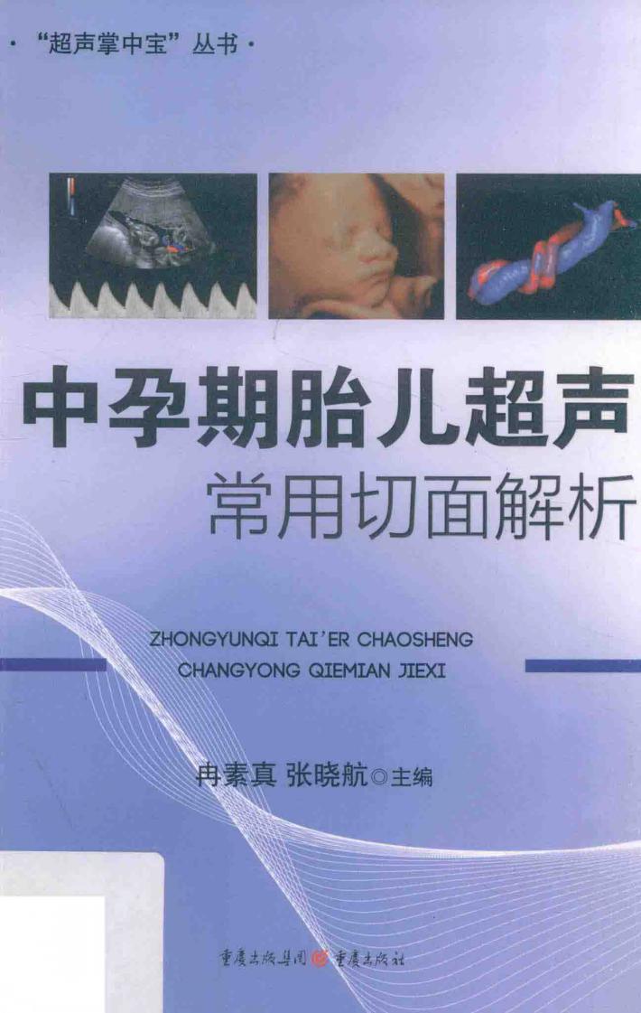 中孕期胎儿超声常用切面解析 封面