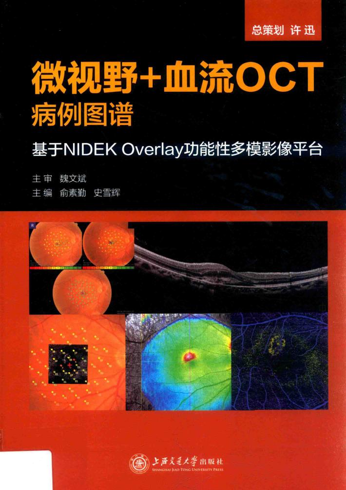 微视野＋血流OCT病例图谱  基于NIDEK Overlay功能性多模影像平台 封面