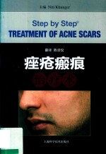痤疮瘢痕治疗术 封面