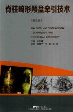 脊柱畸形颅盆牵引技术  普及版 封面
