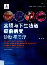 宫颈与下生殖道癌前病变  诊断与治疗 封面