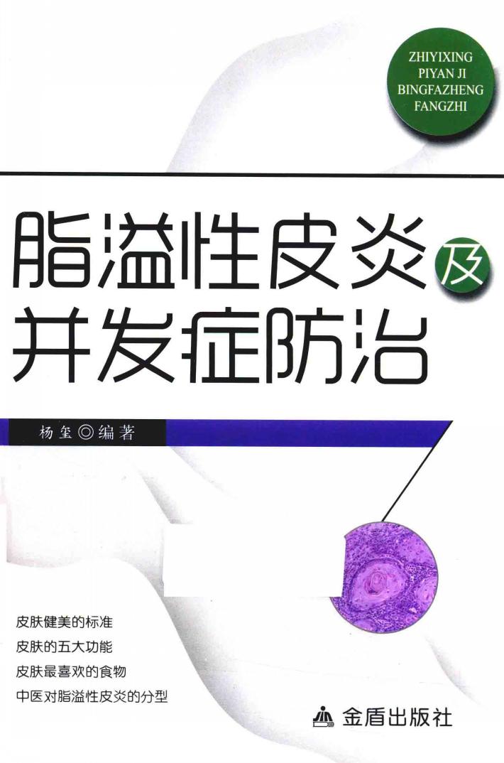 脂溢性皮炎及并发症防治 封面
