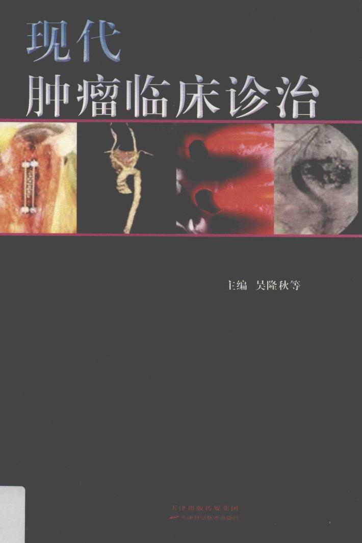 现代肿瘤临床诊治 封面