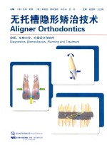 无托槽隐形矫治技术 封面