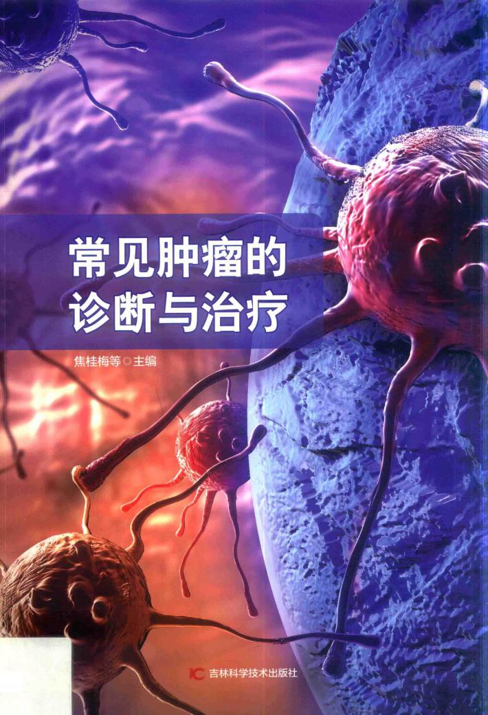 常见肿瘤的诊断与治疗 封面