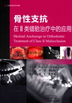 骨性支抗2类错牙合治疗中的应用 封面