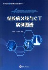 结核病X线与CT实例图谱 电子书封面