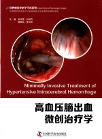高血压脑出血微创治疗学 封面
