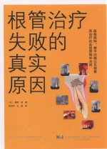 根管治疗失败的真实原因 封面