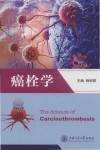 癌栓学 封面