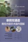 单侧双通道脊柱内镜手术操作图解 封面