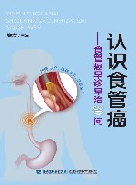 认识食管癌  食管癌早诊早治30问 封面