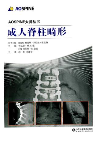成人脊柱畸形 封面