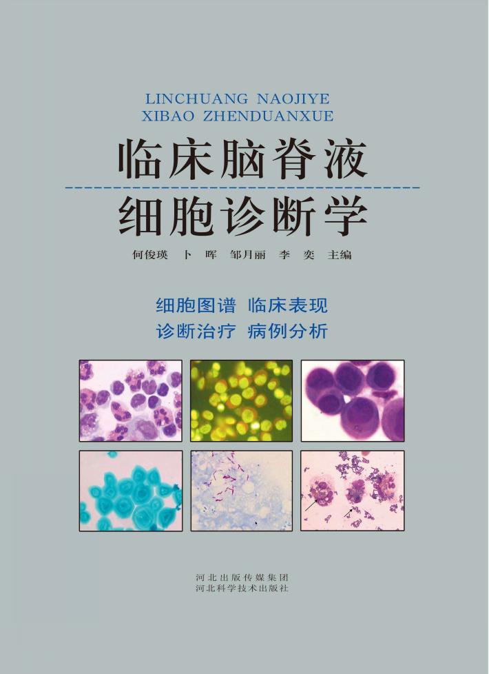 临床脑脊液细胞诊断学 封面