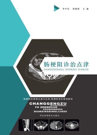 肠梗阻诊治点津 封面