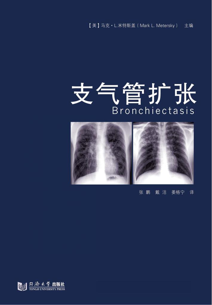 支气管扩张 封面