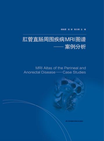 肛管直肠周围疾病MRI图谱  案例分析 封面