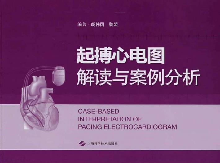起搏心电图解读与案例分析 封面