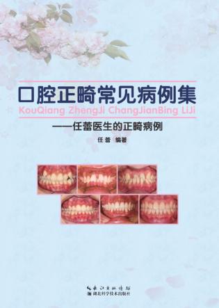 口腔正畸常见病例集  任蕾医生的正畸病例 封面