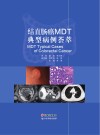 结直肠癌MDT典型病例荟萃 封面